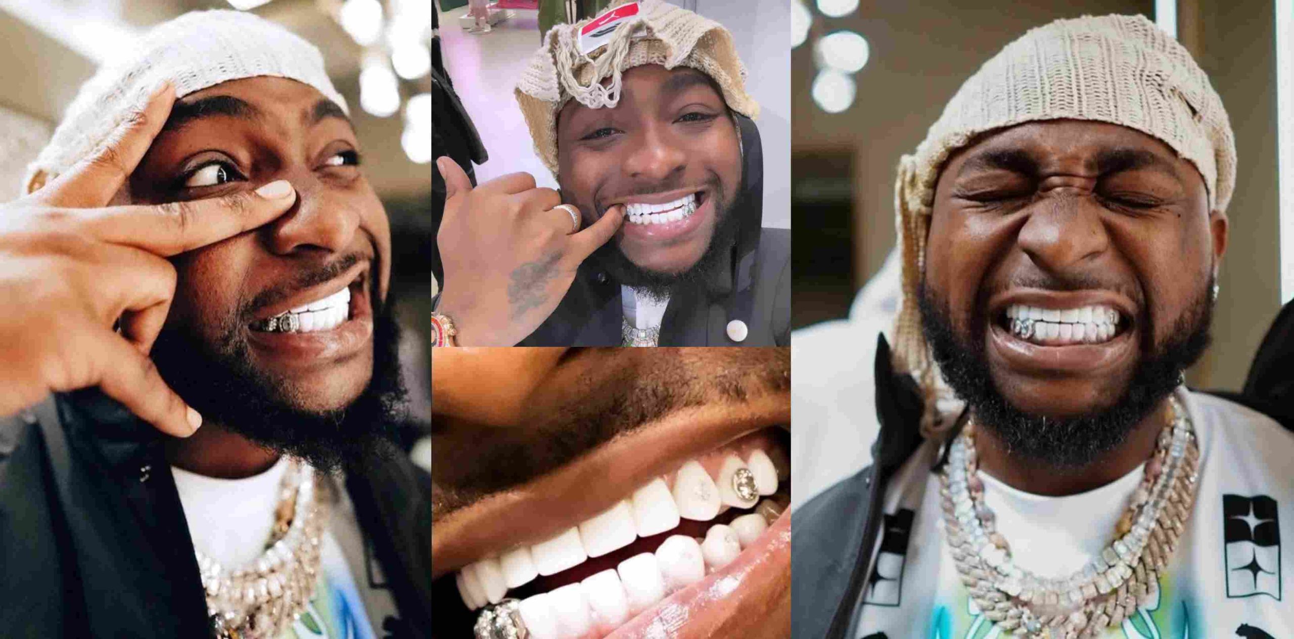 Singer Davido stuns many as he shows off diamonds worth N47M on his teeth